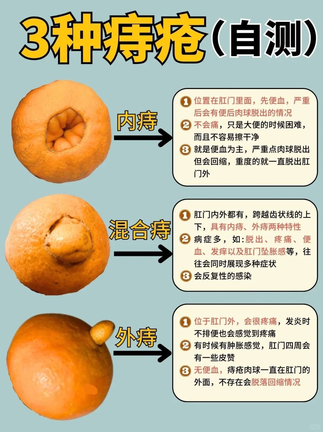 炎性外痔疮的症状有什么?