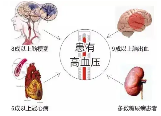 颅内压增高的三主征是什么?