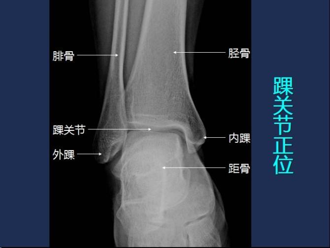 无安筠