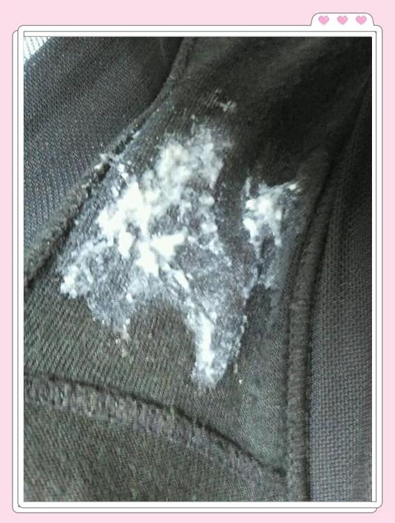 白带豆腐渣状