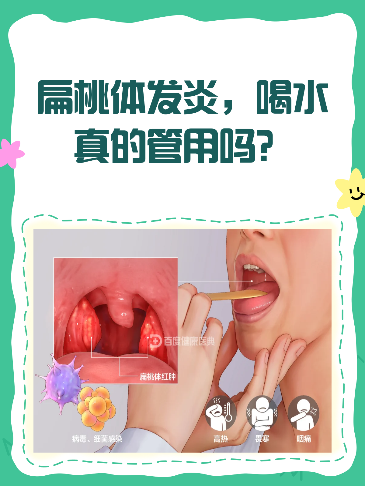 扁桃体发炎,该挂哪个科