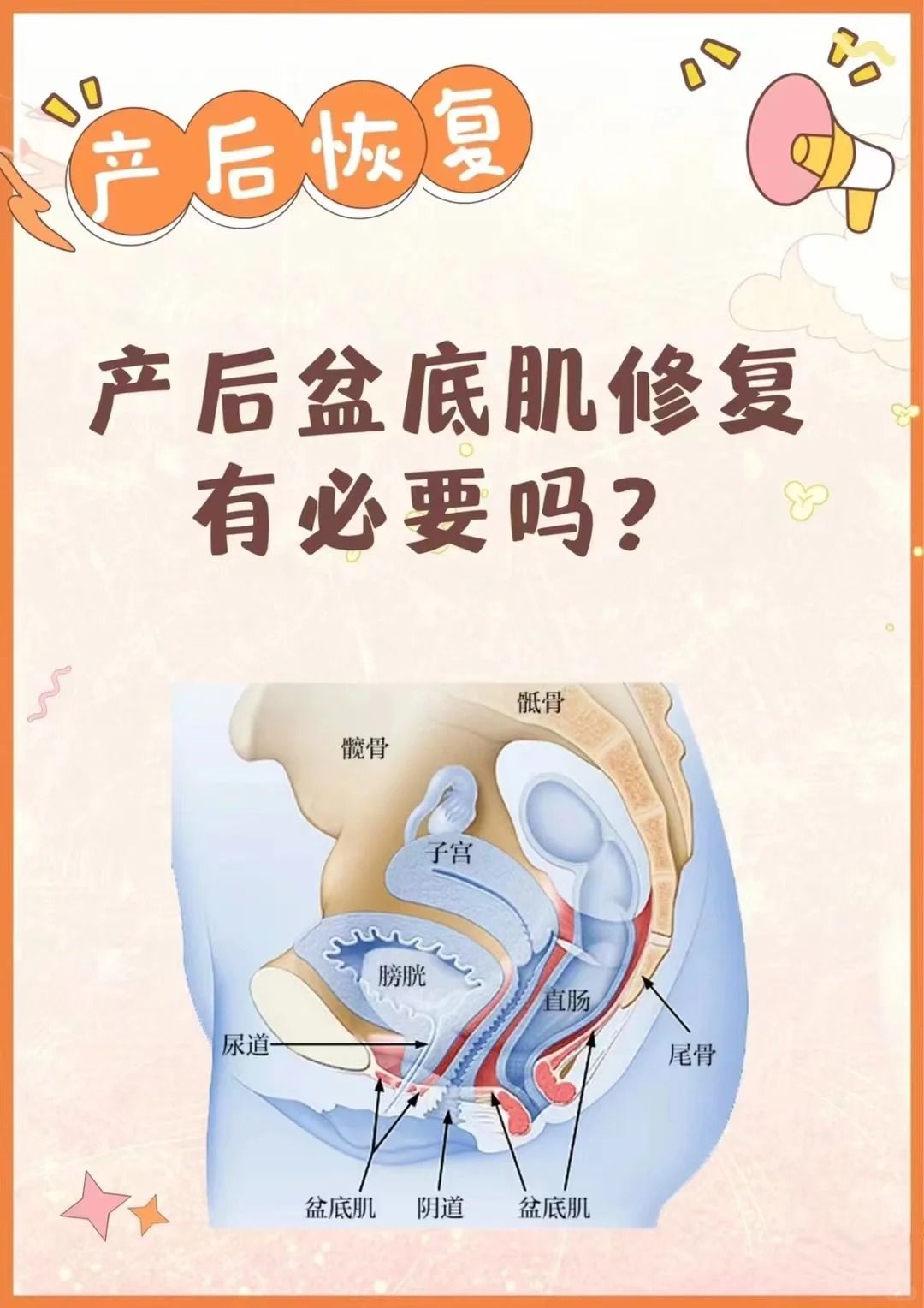 盆底恢复有必要做吗