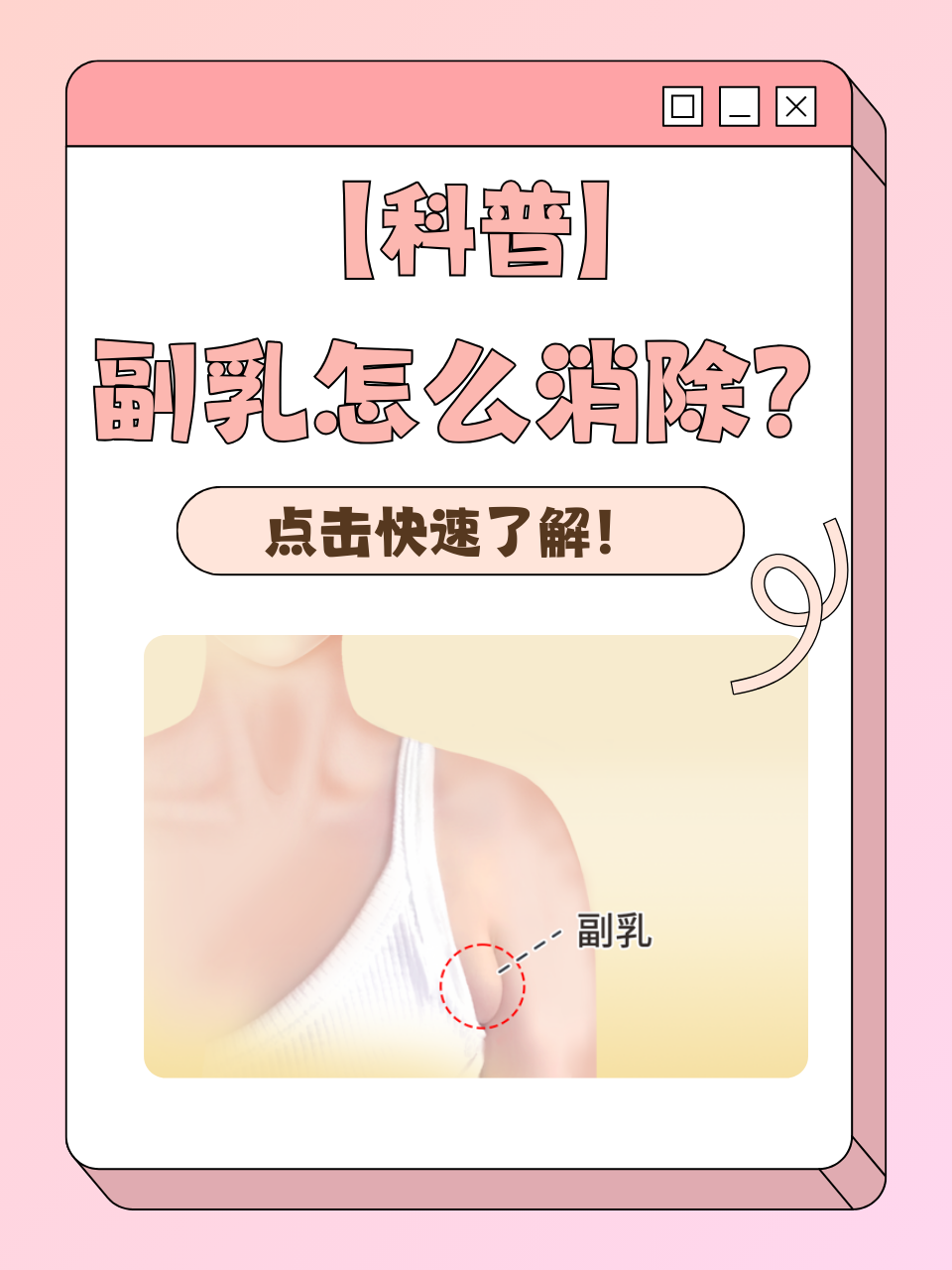 附乳是什么