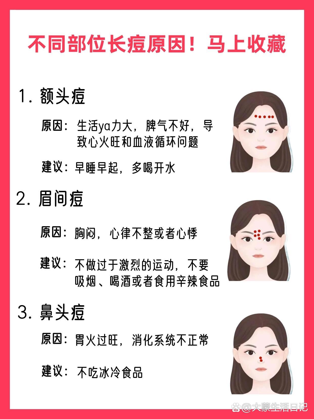 太阳穴两边长痘痘是什么原因?
