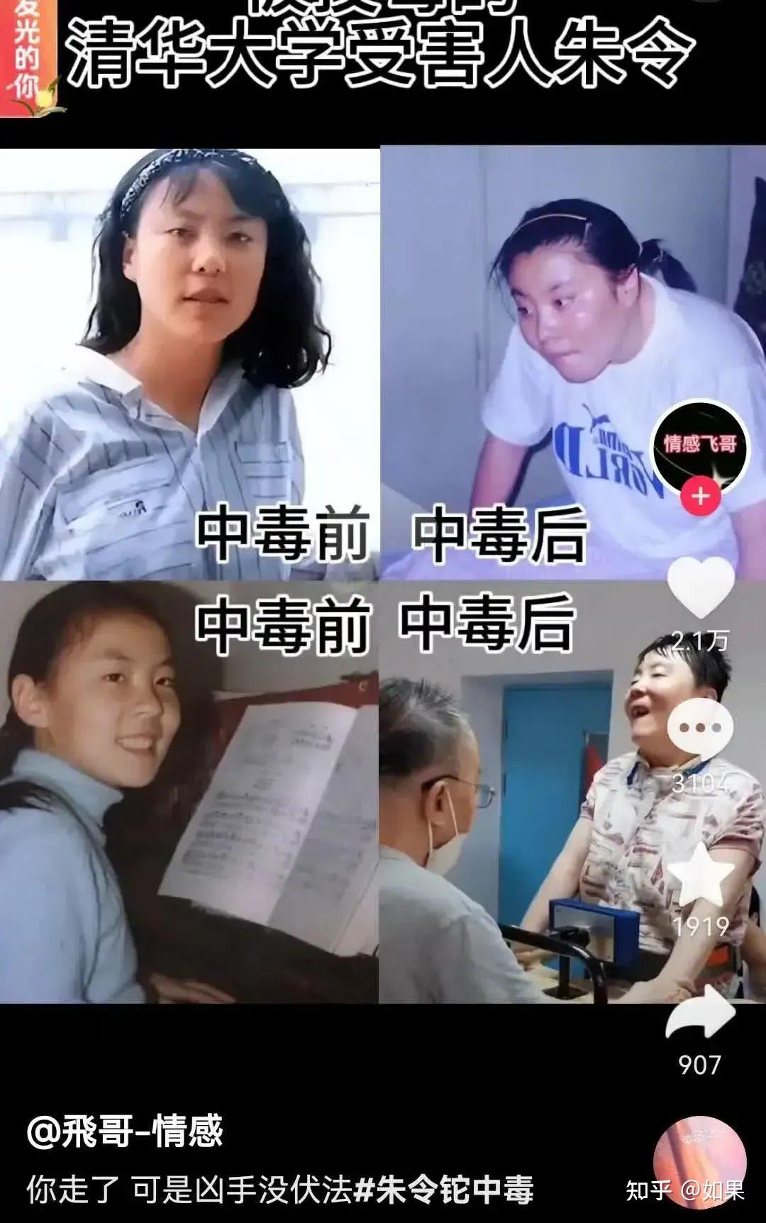铊中毒的症状有哪些