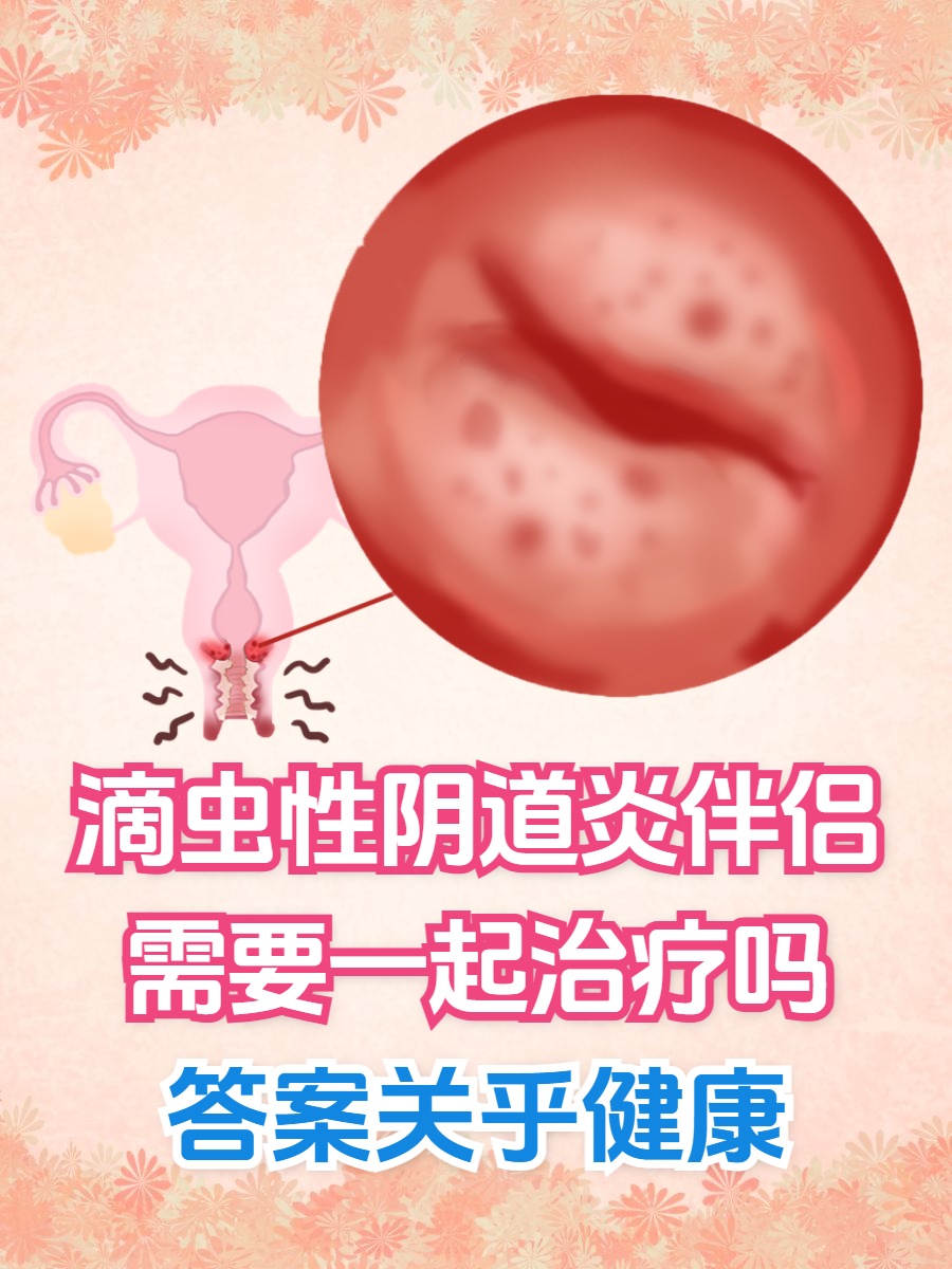 什么是滴虫感染?