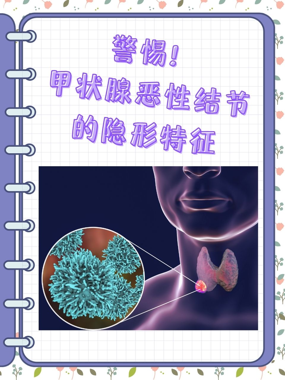甲状腺右叶低回声结节是什么意思?