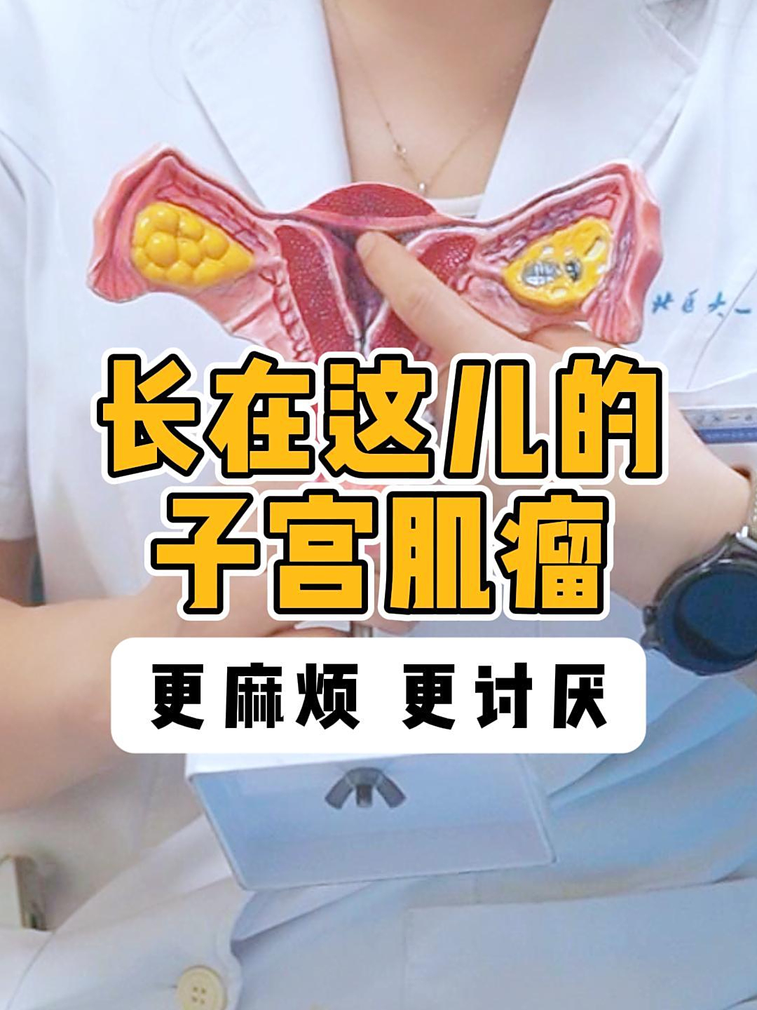 女性为什么会得子宫肌瘤