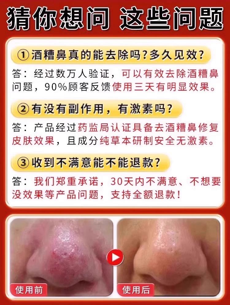 酒糟鼻子怎么根治