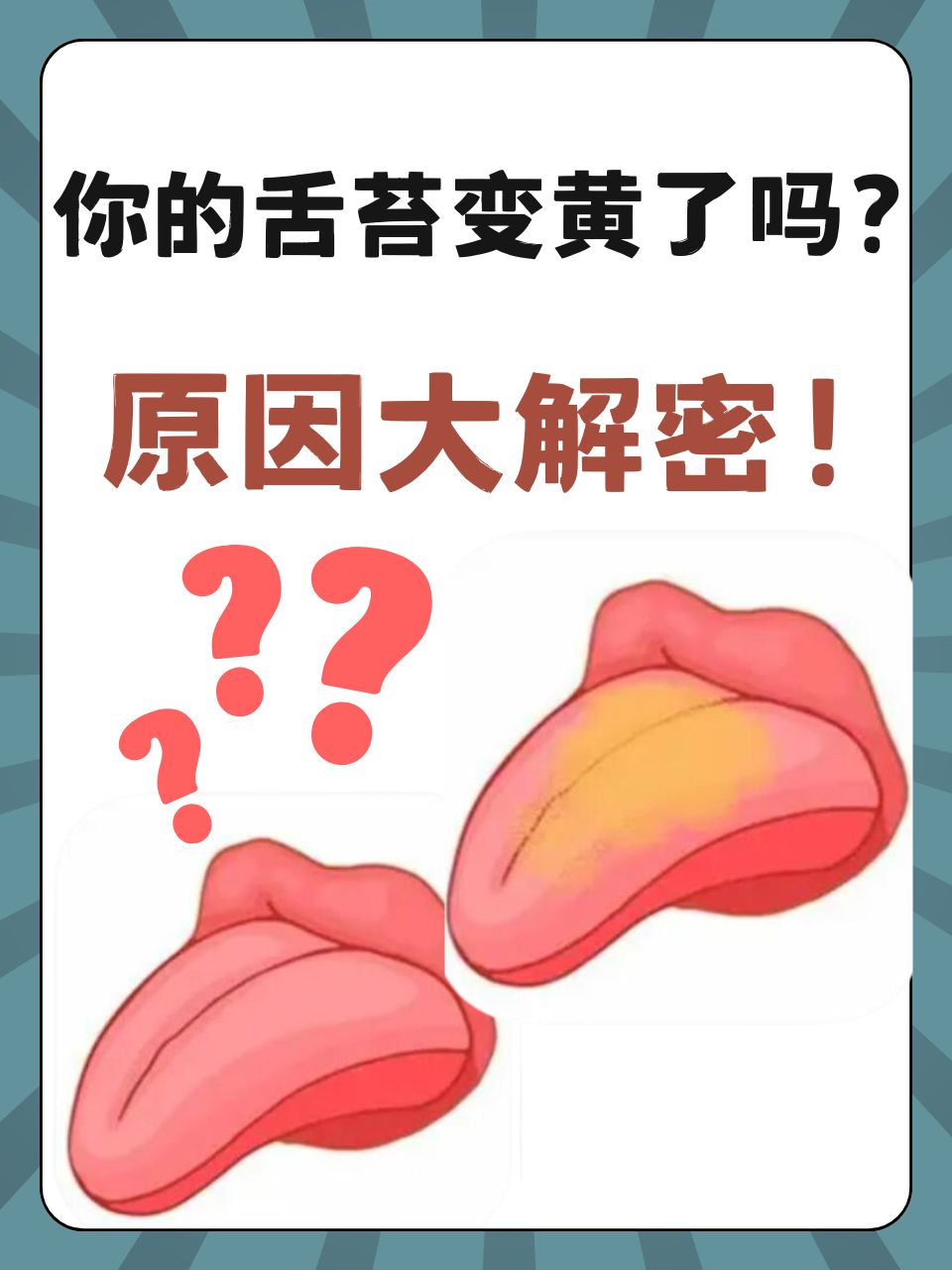 舌苔厚黄是怎么回事?