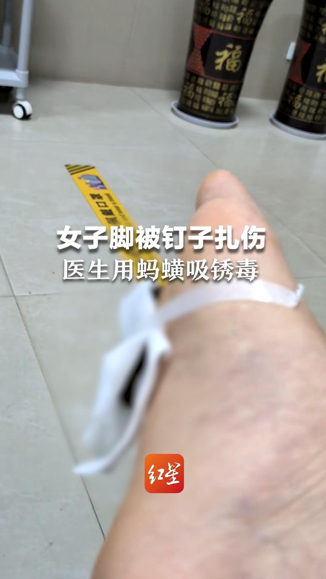 脚被钉子扎伤怎么办?
