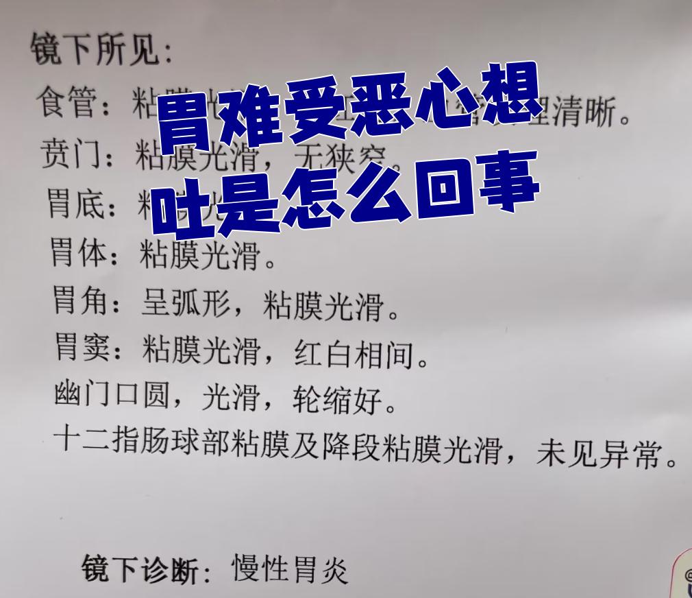 赵慧艳