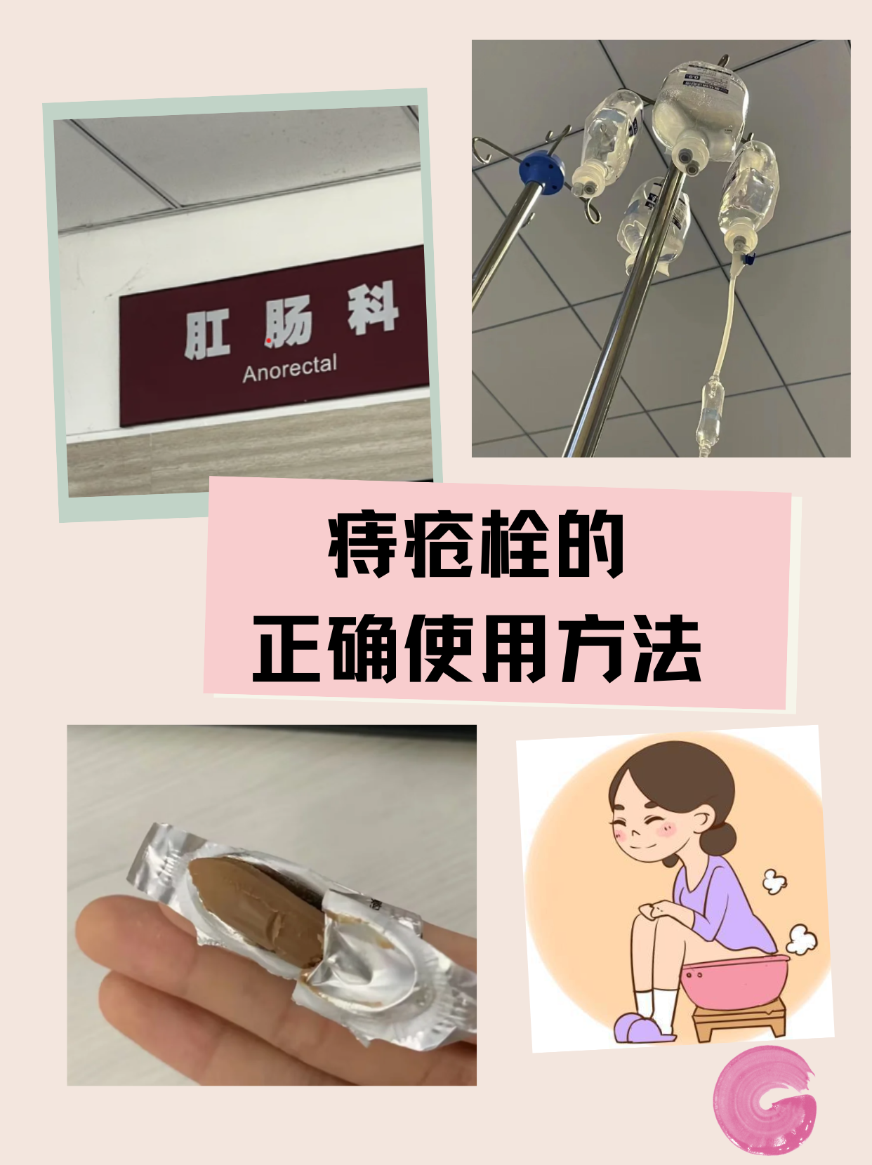 普济痔疮栓的作用