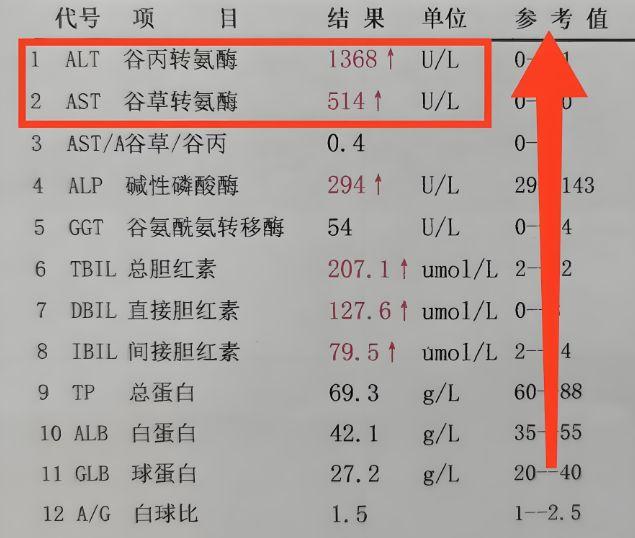 谷丙转氨酶高的危害