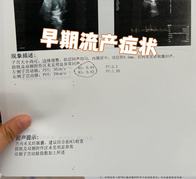 先兆性流产的症状特征是什么
