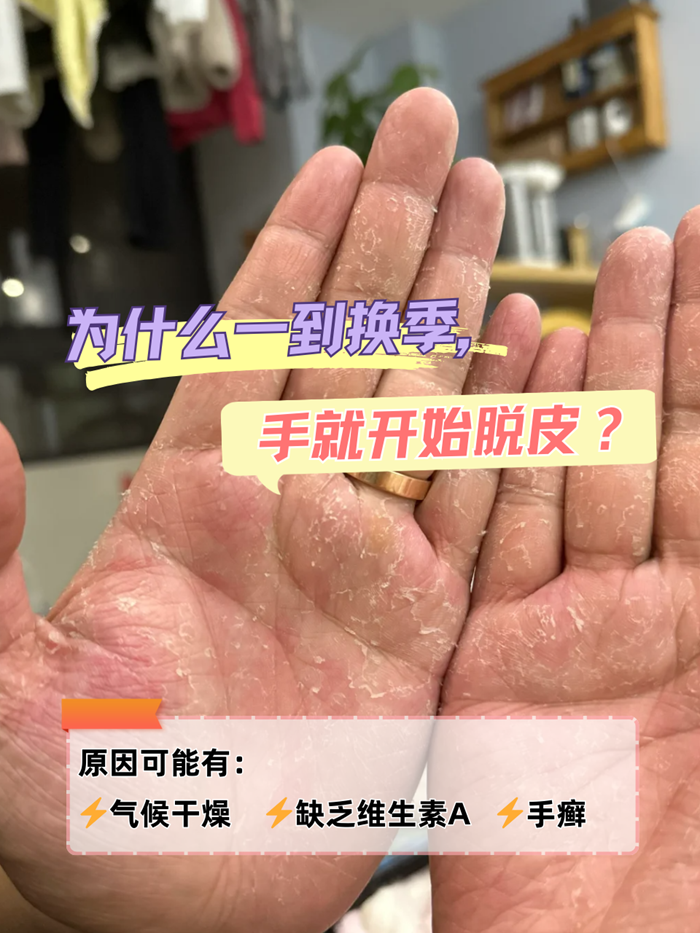 手起皮是什么原因