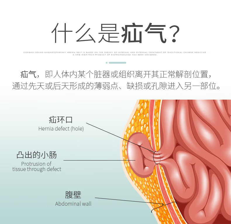 什么是疝气带疗法,?