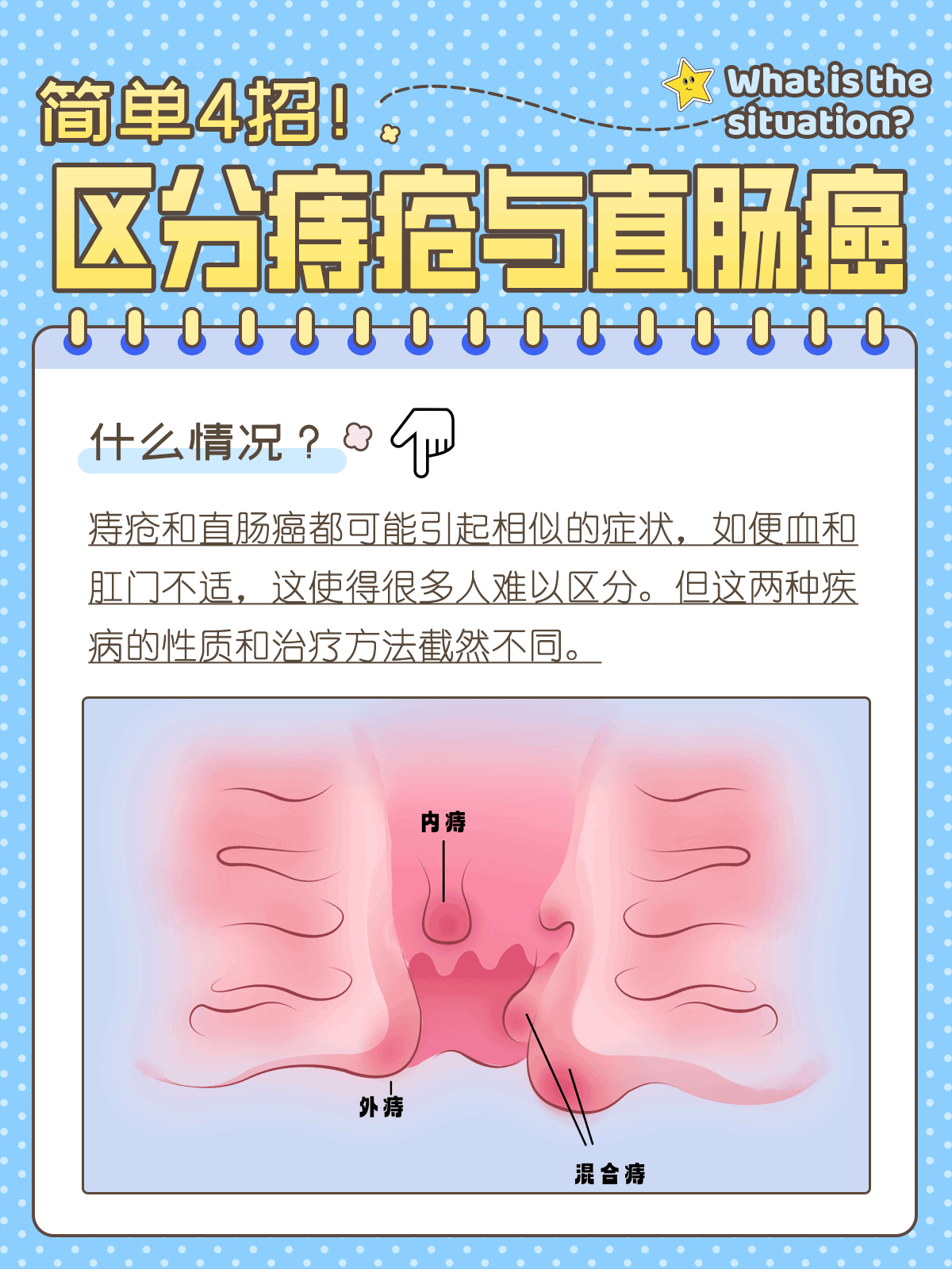 痔疮的初期症状有哪些