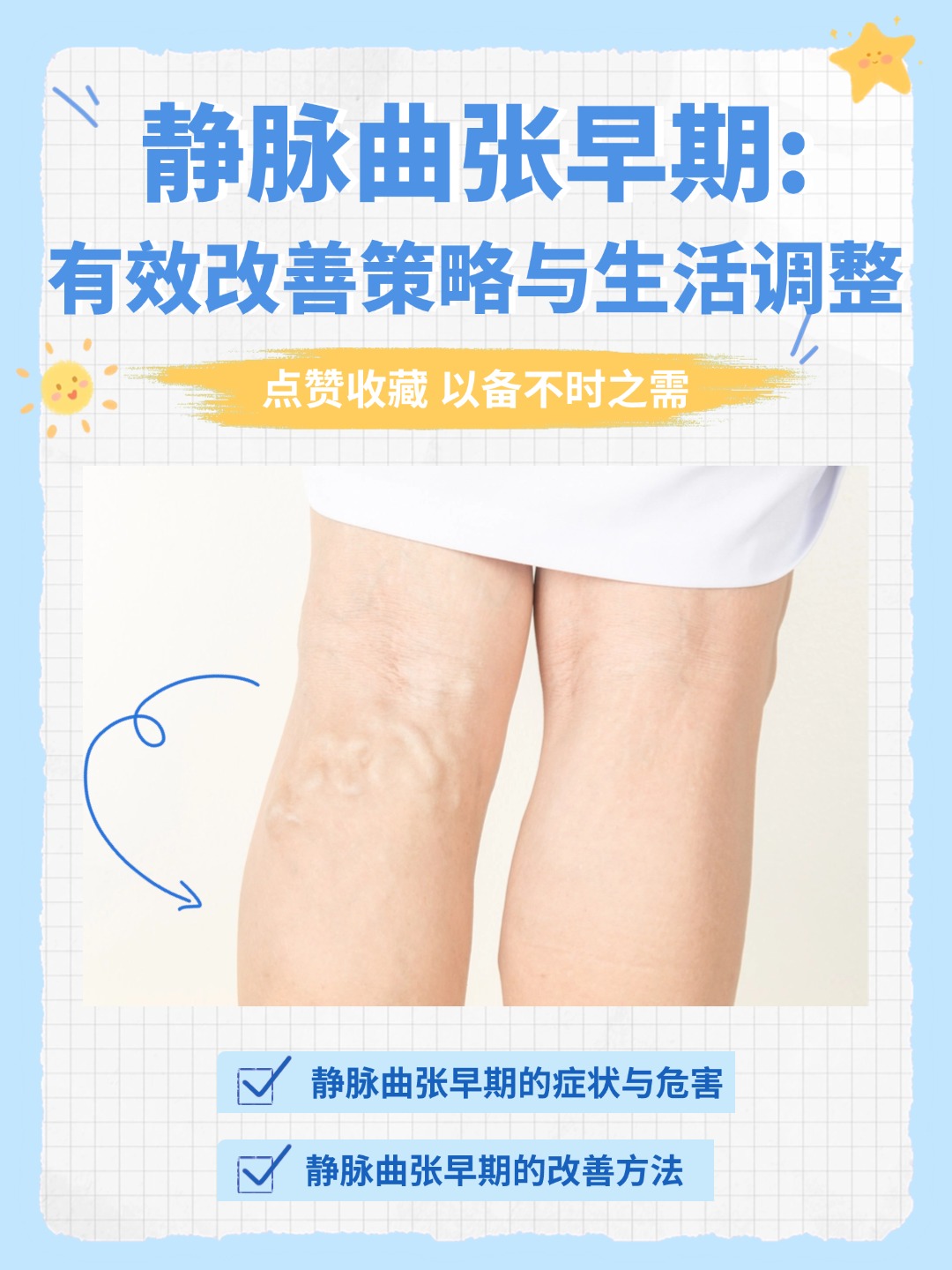 静脉曲张都是什么原因造成的?