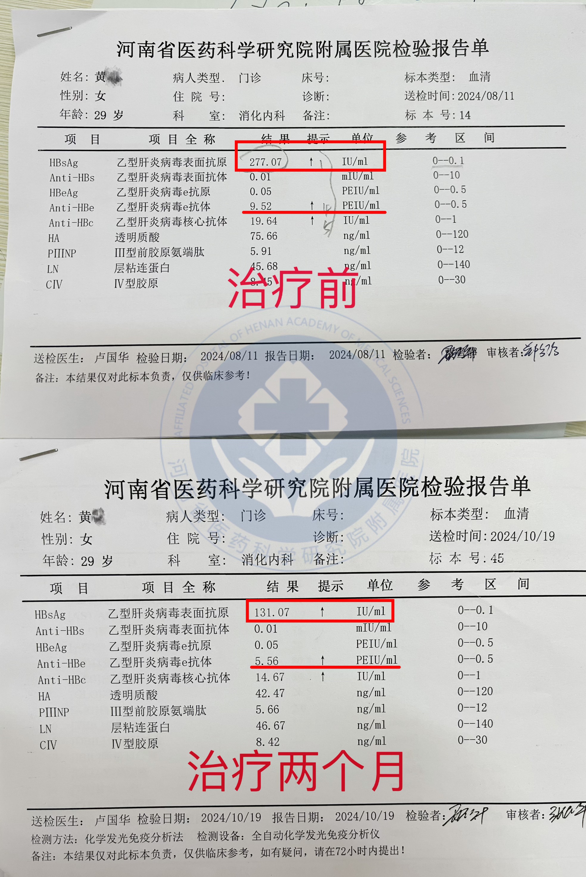 ALT偏高,怎么治疗