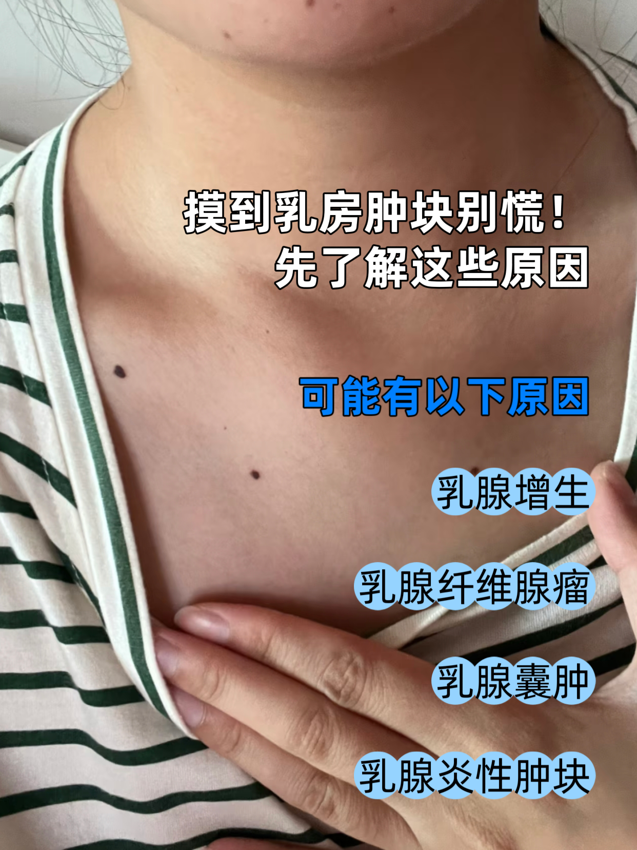 乳房有硬块正常吗