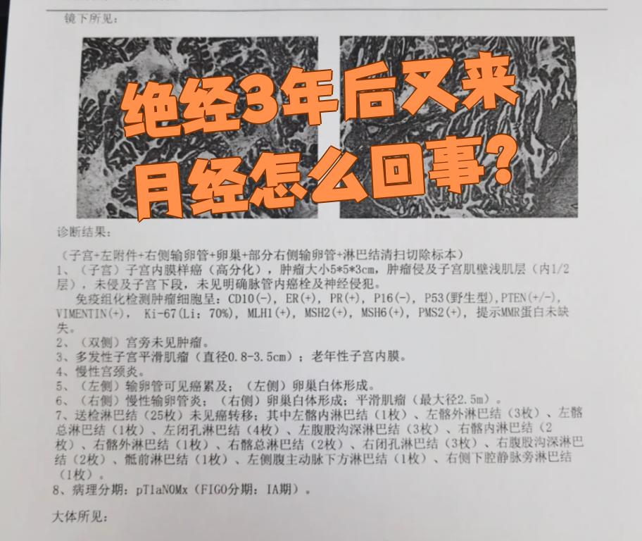 绝经后出血是怎么回事?