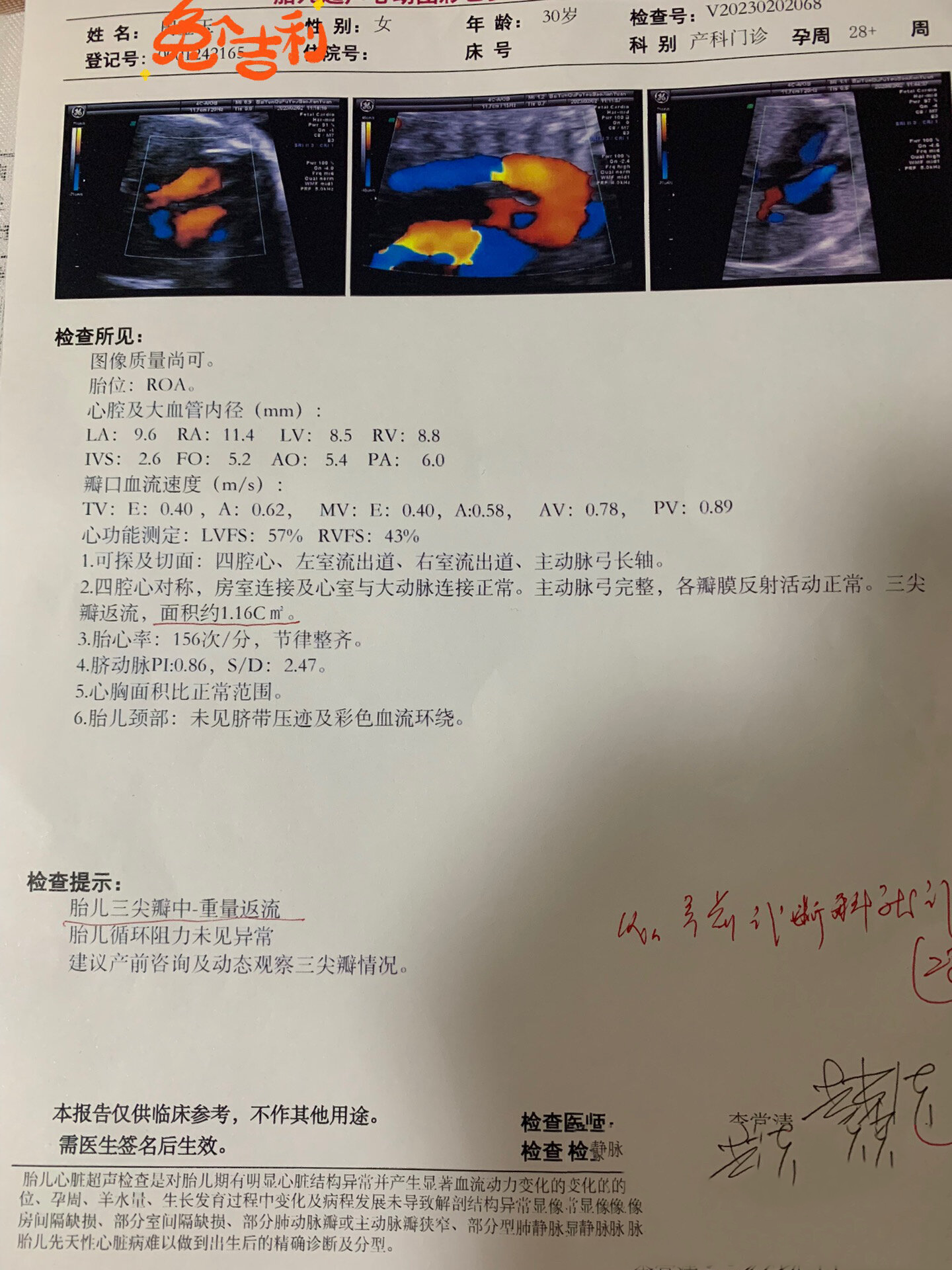 心脏彩超能排除什么病