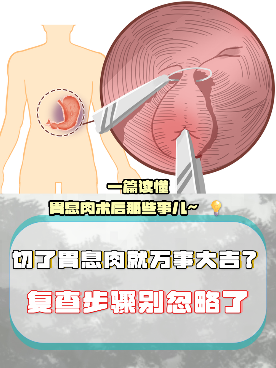 胃息肉一定要做手术吗?