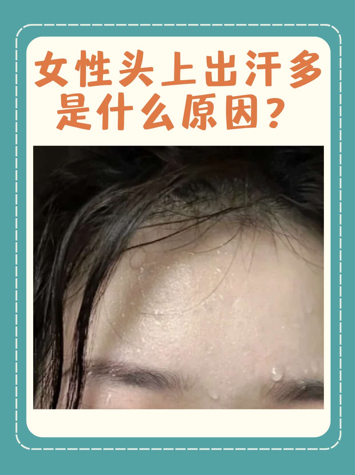 脸上出汗多是怎么回事