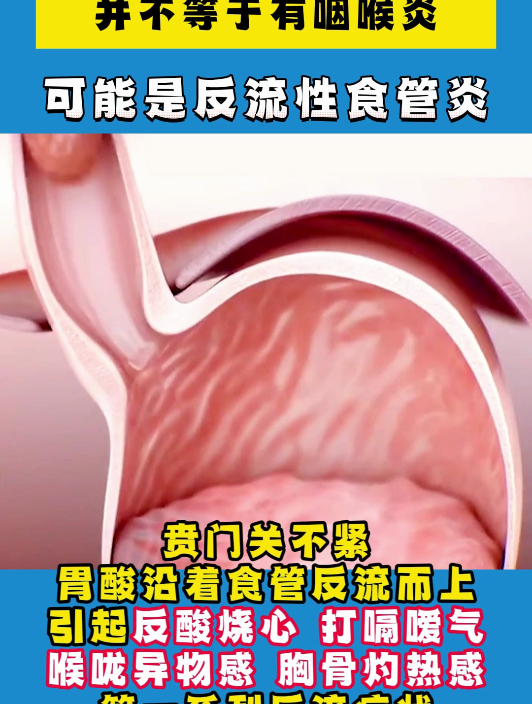 喉咙部感觉有东西堵着