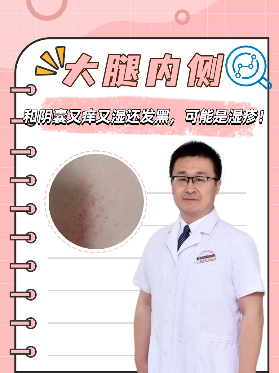 大腿根痒是怎么回事