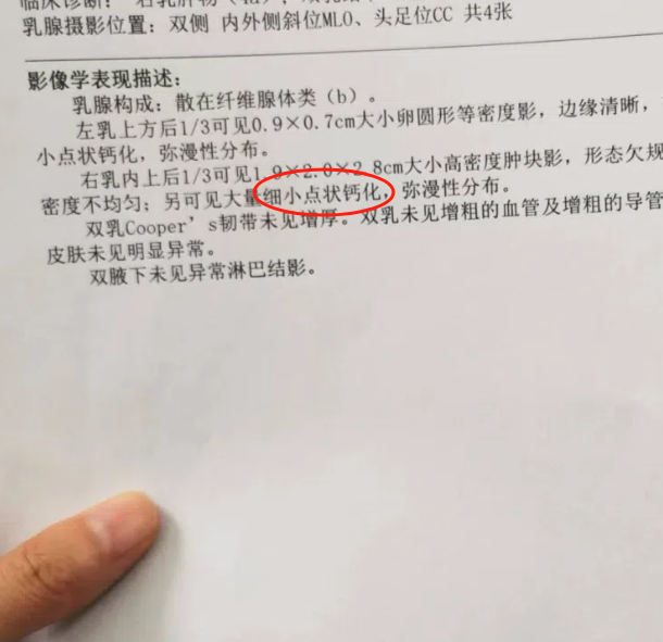 33岁3个月做了2次钼靶有害吗