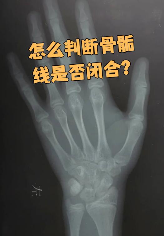 广白凡