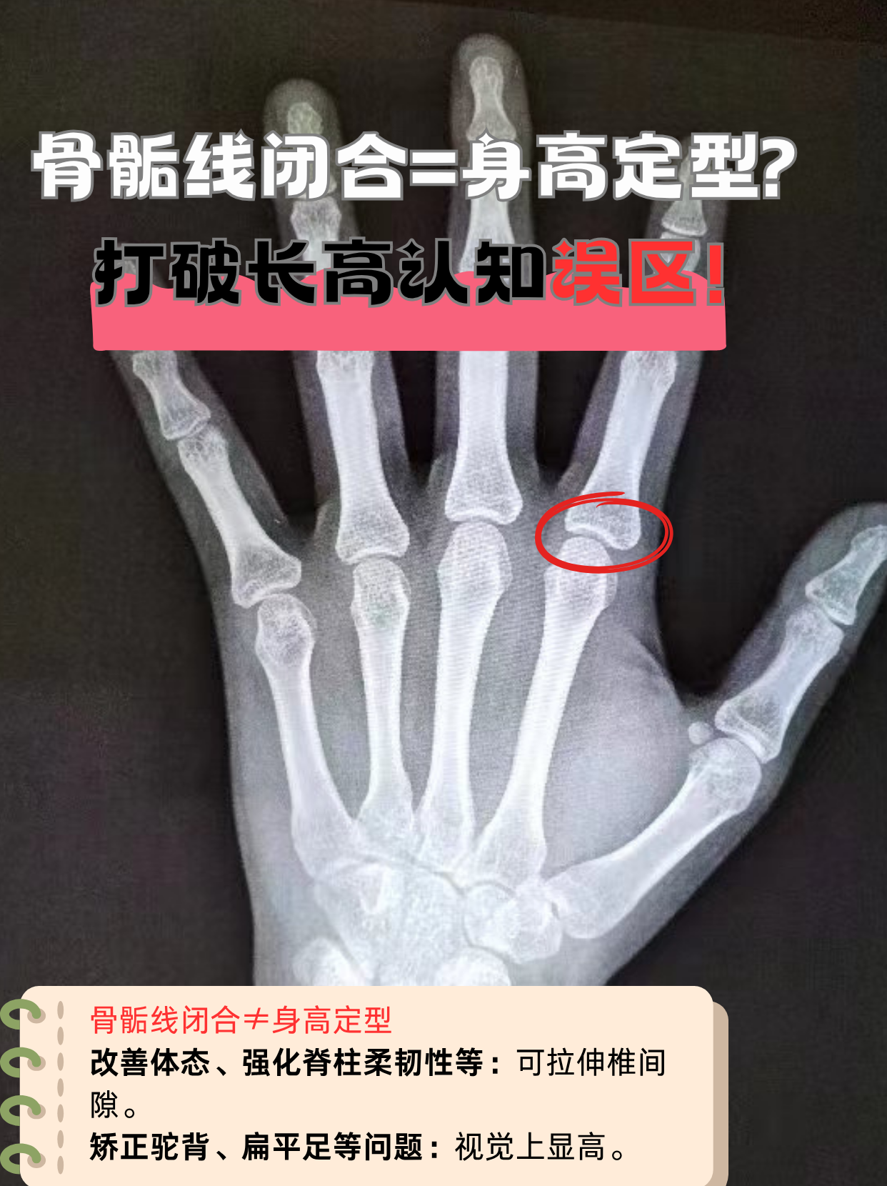 骨头闭合了还能长高吗