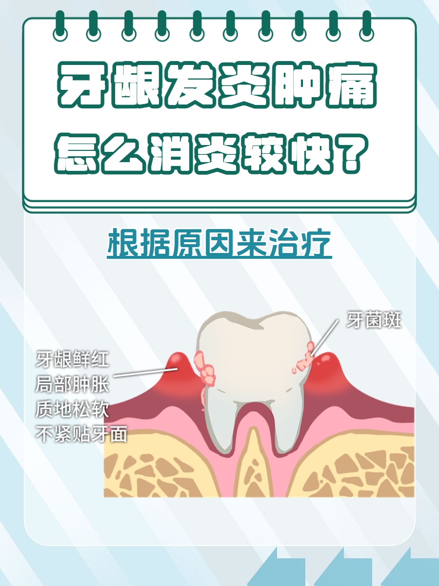 牙龈增生怎么办