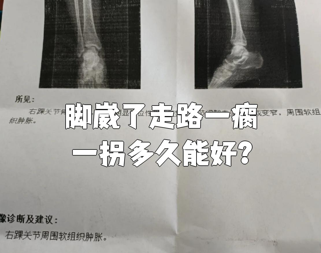 脚部软组织损伤多久能好