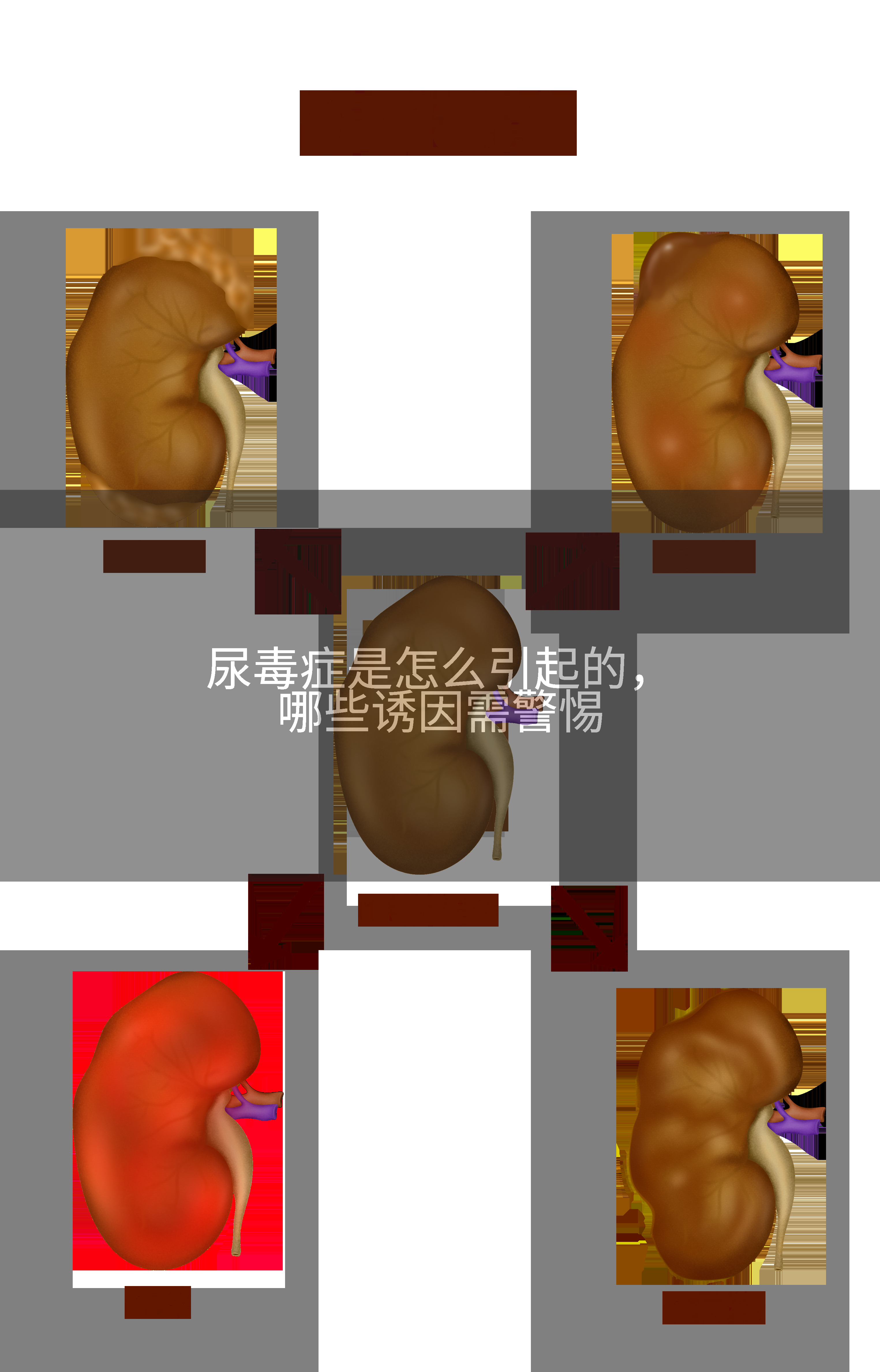 尿毒症都是怎么引起的