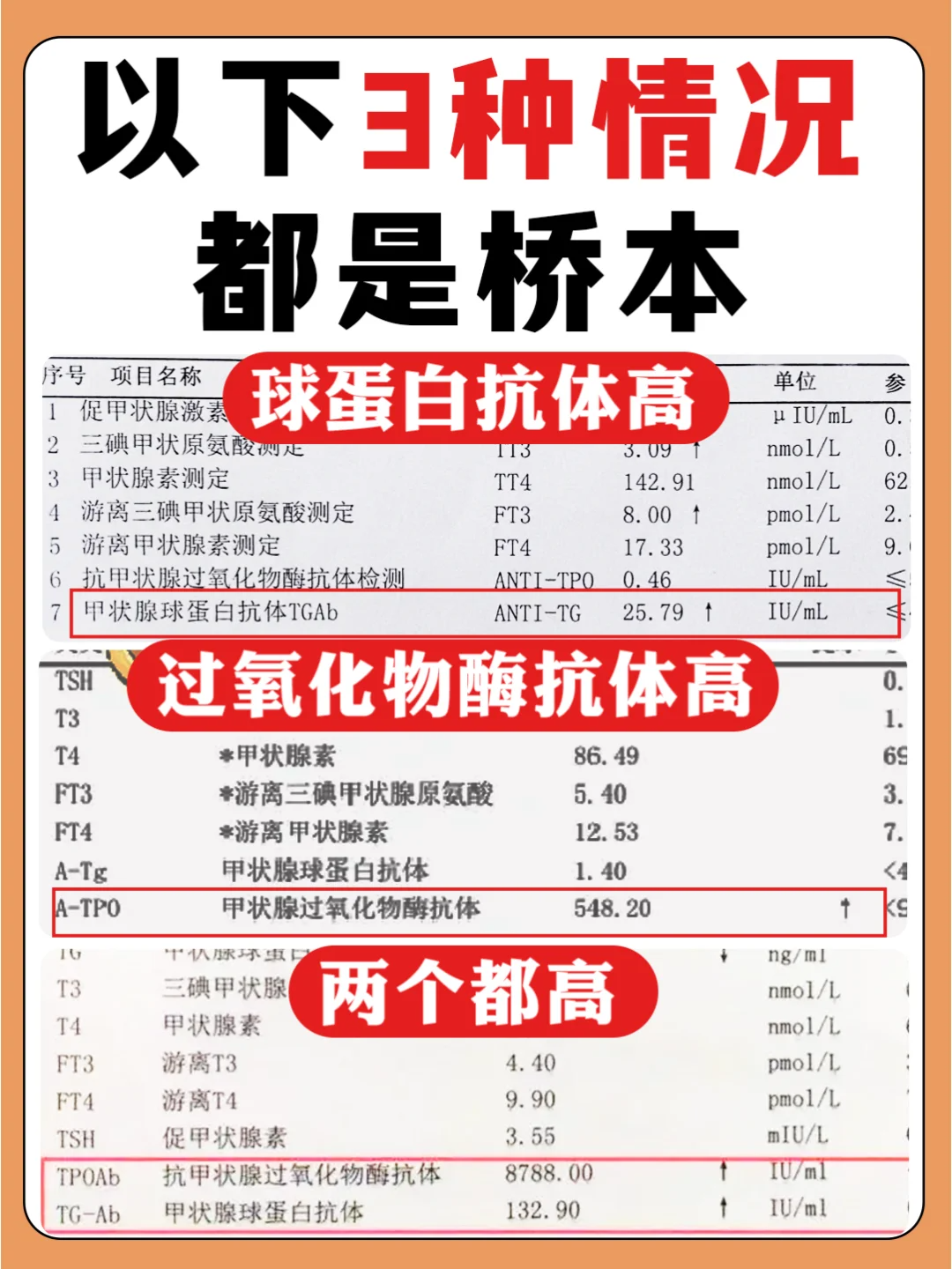 什么叫抗甲状腺球蛋白抗体