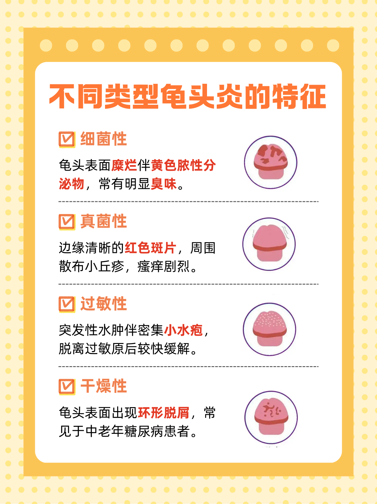 治包皮龟头炎要多少钱