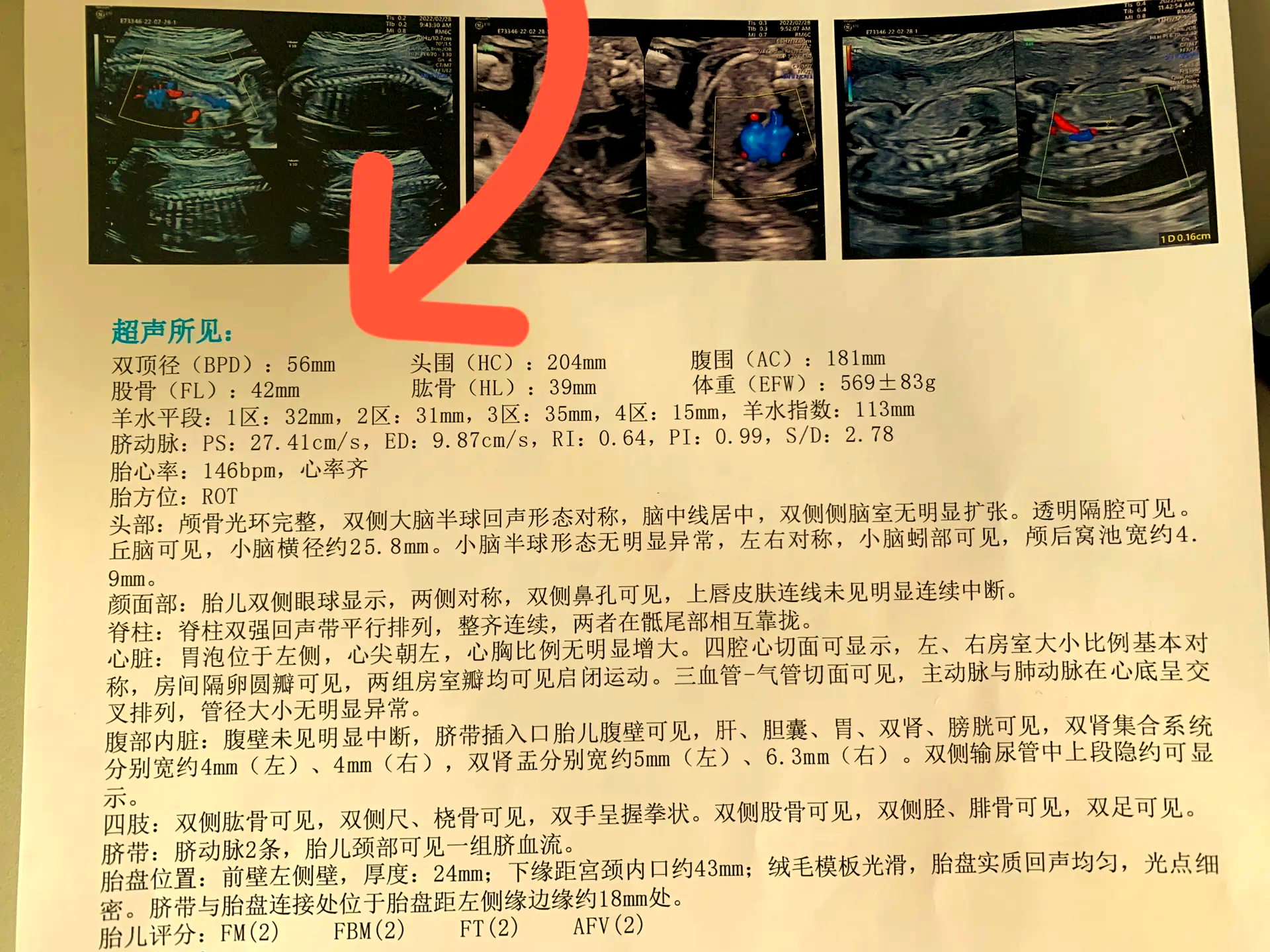 彩超查什么