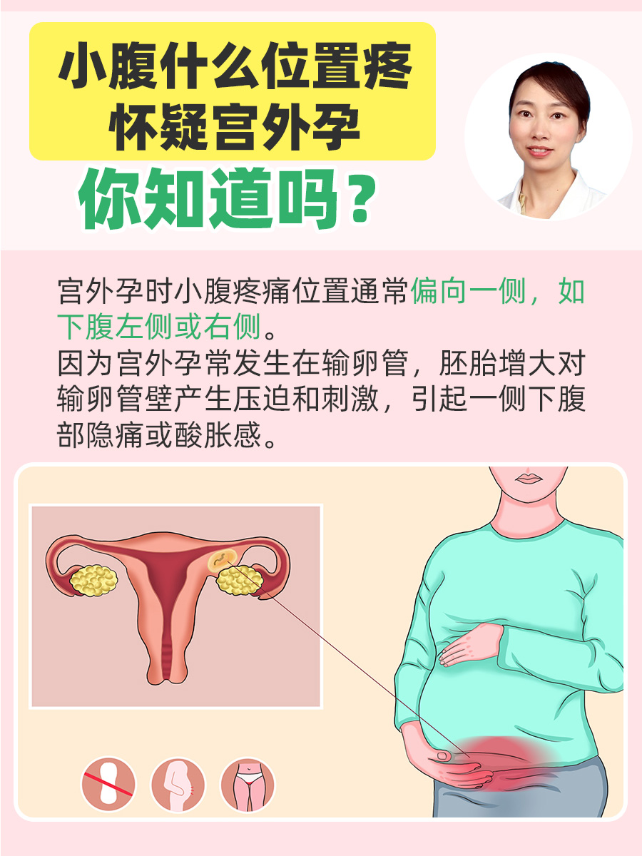 宫外孕有什么特征和反应