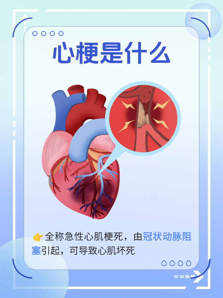 心血管疾病有哪几类