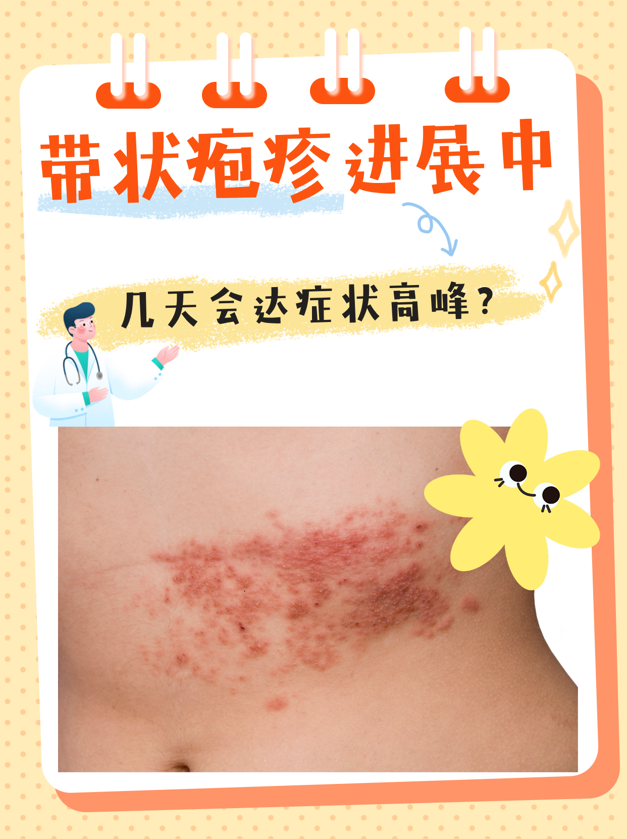 带状疱疹怎么引起的?