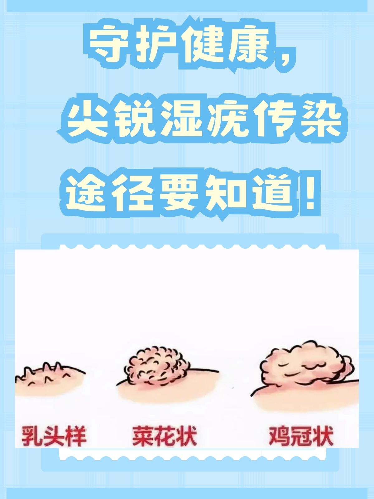 尖锐湿疣潜伏期多久.