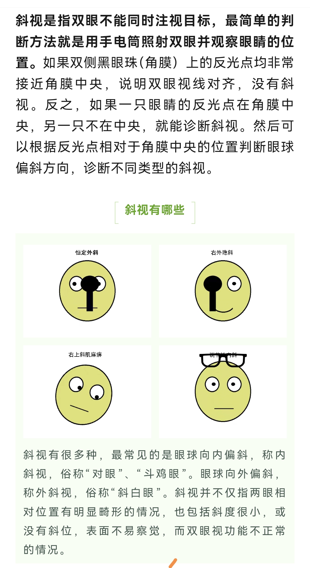 眼睛斜视的原因