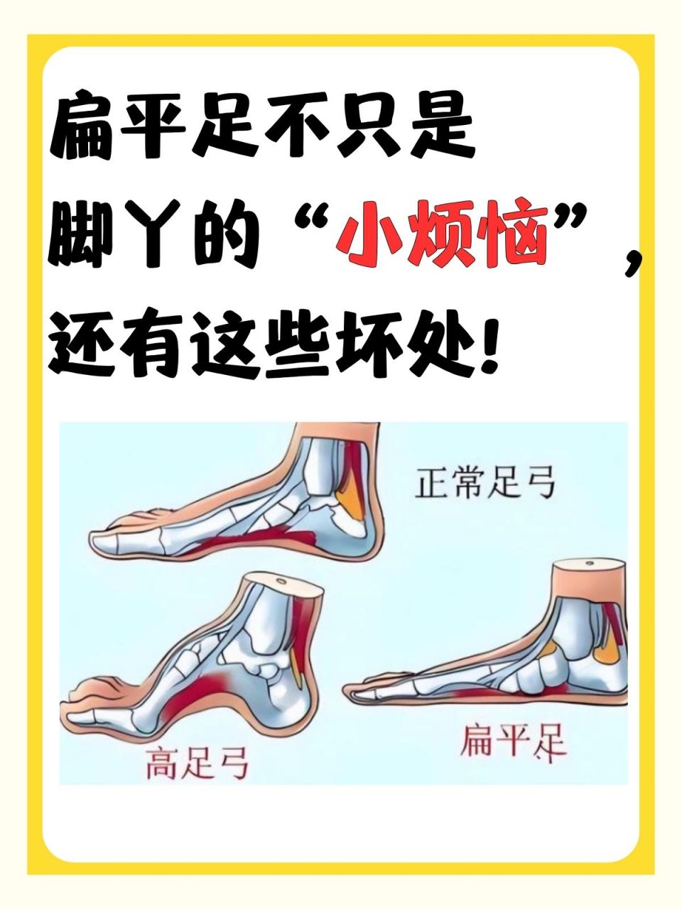 平足有什么危害