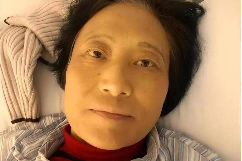 脸色发黄是肝不好吗