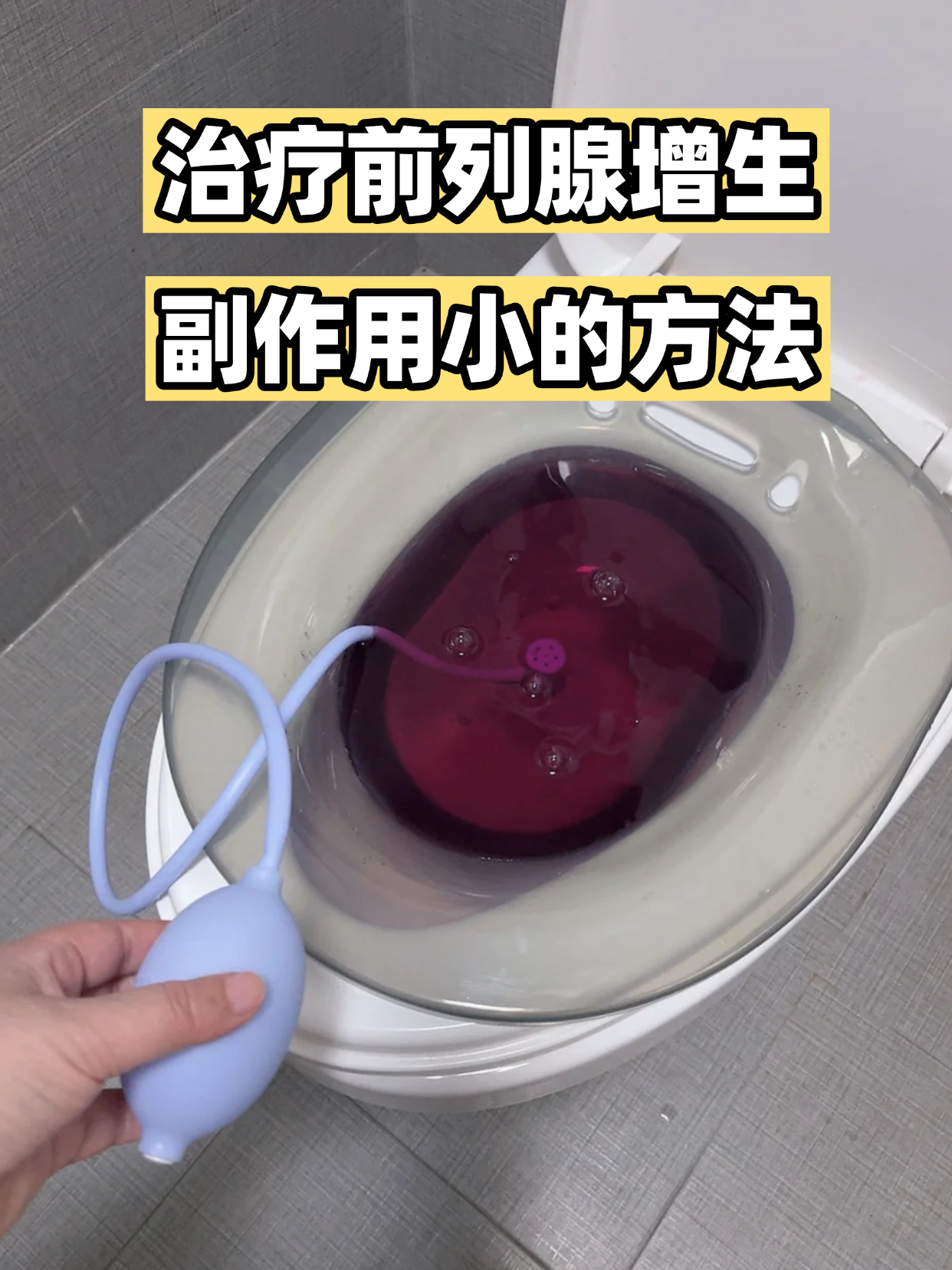 前列腺增大怎么治疗?