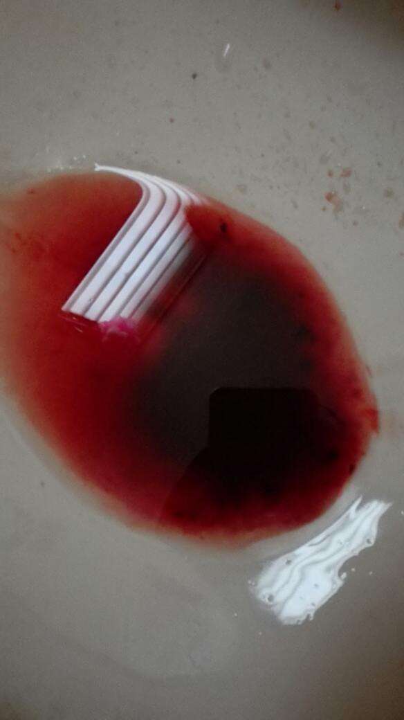 月经颜色应该是什么样子