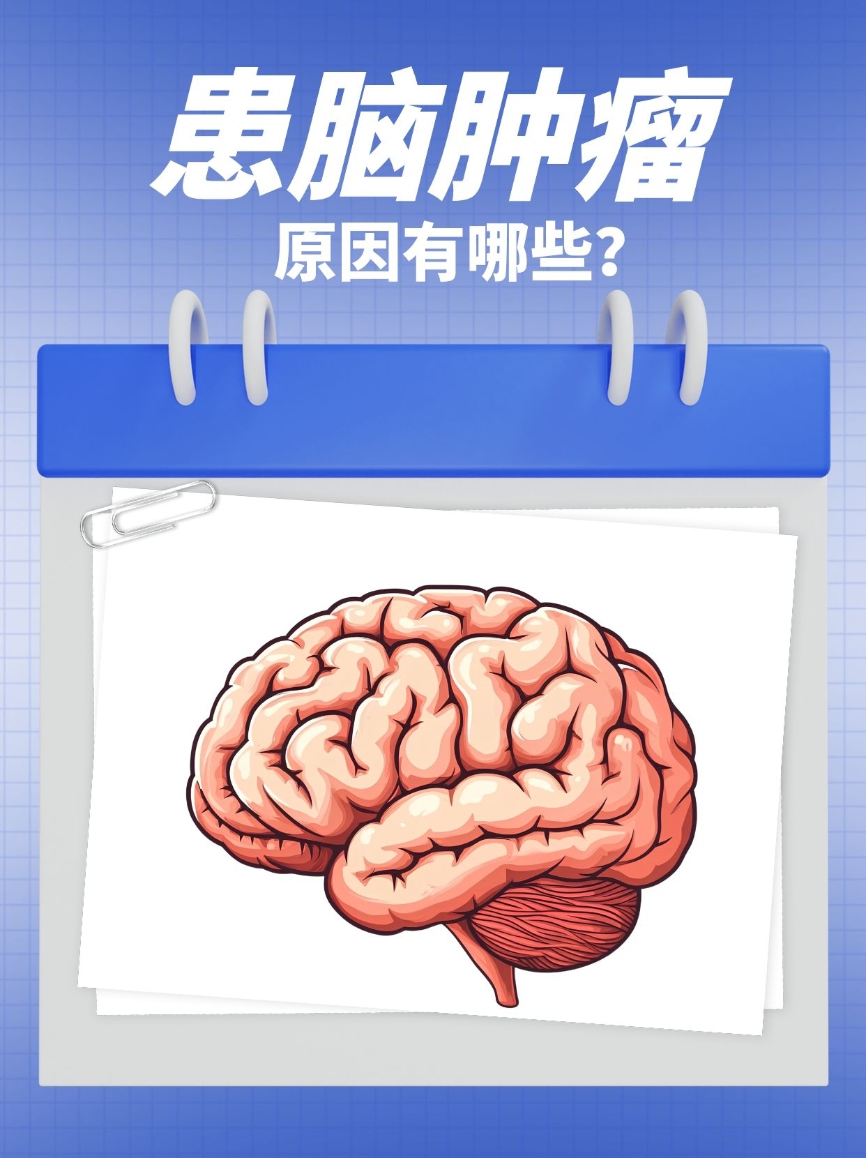 脑转移瘤是什么原因引起的?